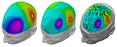 Gehirn Hypnose Hypnosetherapie Wien